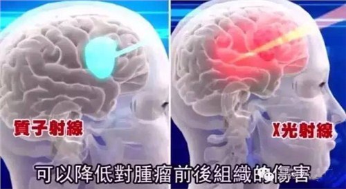 成都瑞庚医疗科技咨询有限公司治脑*