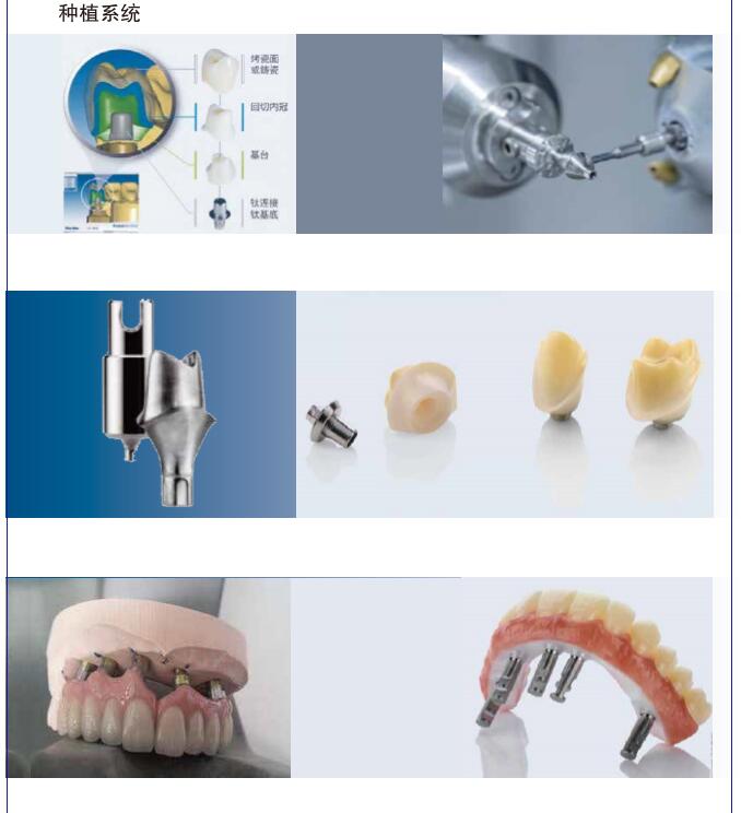 口内扫描3d打印在牙科的应用