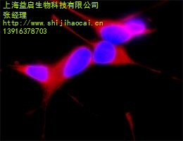 β-Tubulin III抗体 β-Tubulin III抗体** β-Tubulin III抗体供应 益启供